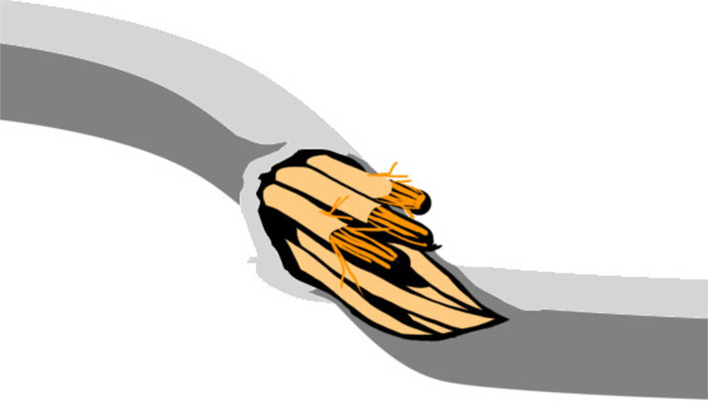 Kabel_(1).jpg