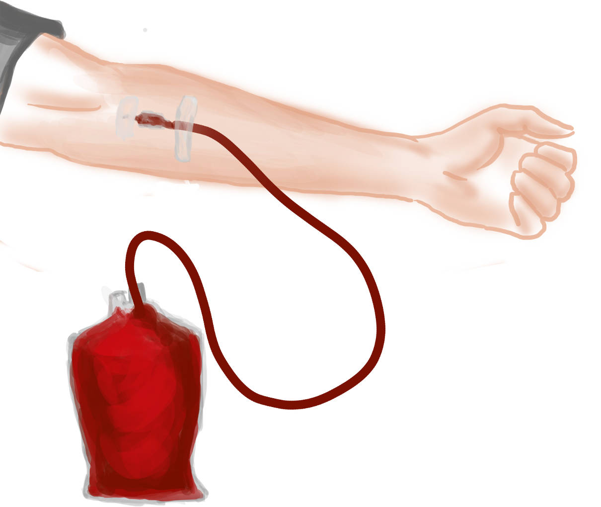 Bluttransfusion.jpg
