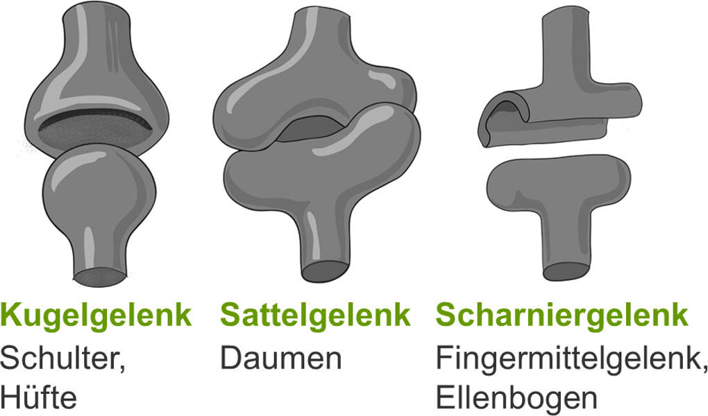 Gelenkformen