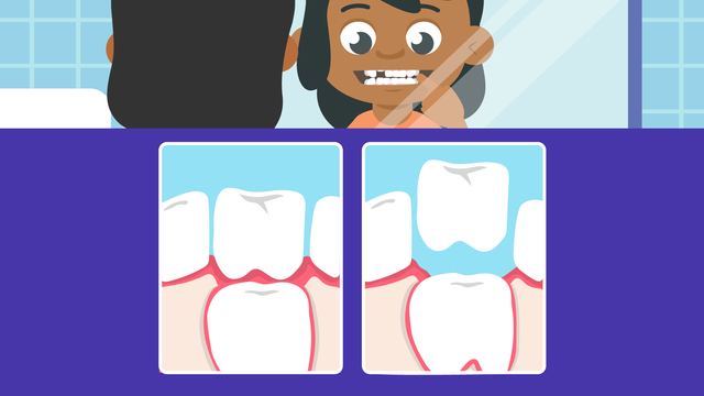 Your Teeth – Made Easy